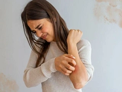 Egzama Nedir? Nasıl Tedavi Edilir?